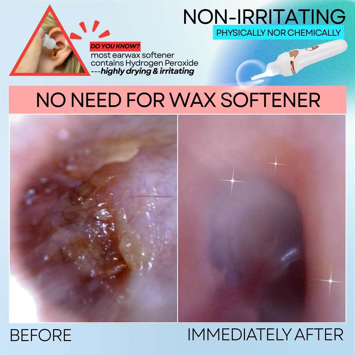Earwax Vacuum – Safe & Painless Ear Cleaning for the Whole Family