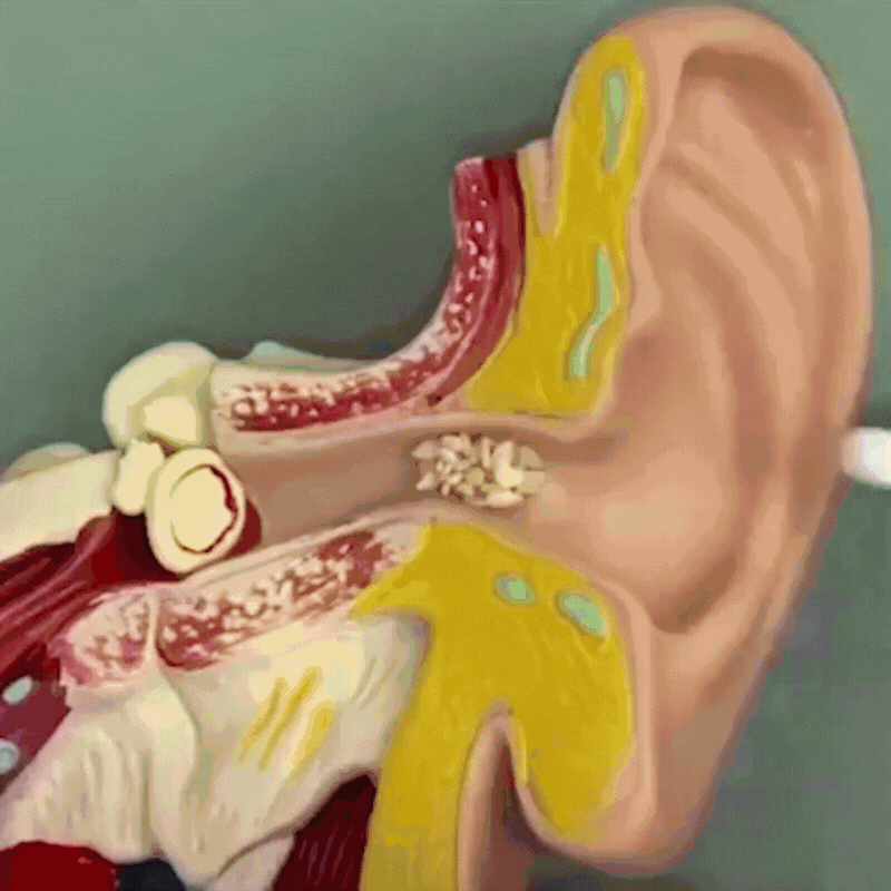Earwax Vacuum – Safe & Painless Ear Cleaning for the Whole Family