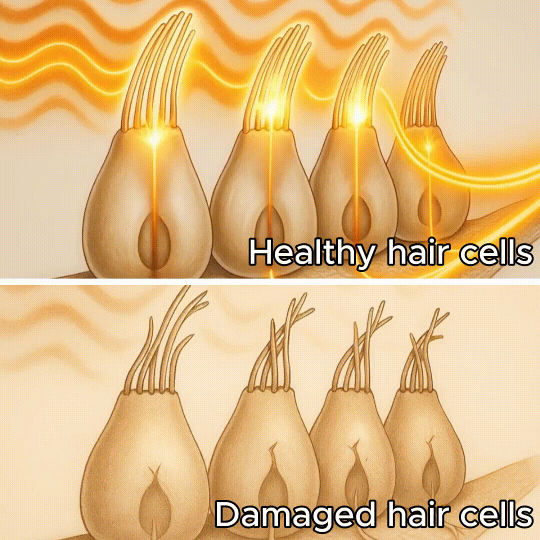 Hearlumi Red Light Therapy for Ears