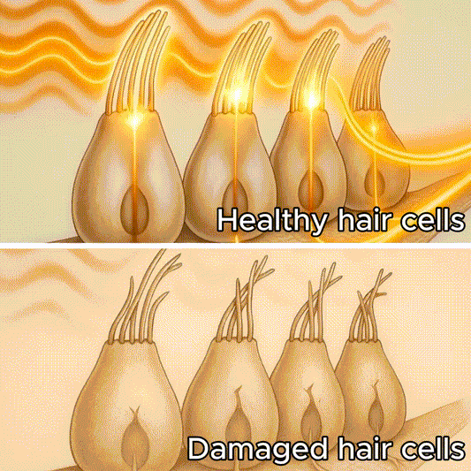 Hearlumi Red Light Therapy for Ears